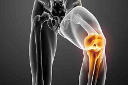 Αρθροσκόπηση γόνατος - ελάχιστα επεμβατική χειρουργική